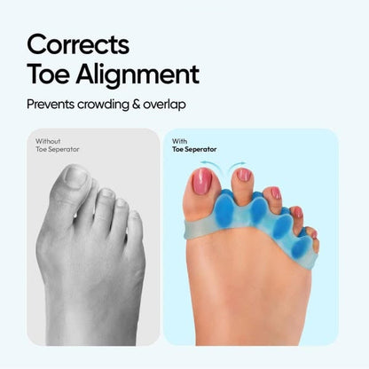 5-Toe Silicone Separator – Gentle Toe Alignment