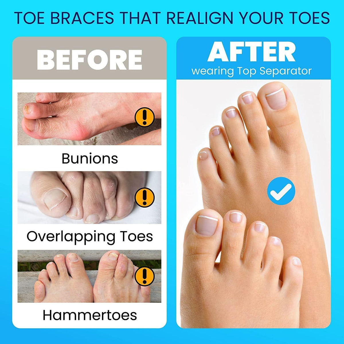 5-Toe Silicone Separator – Gentle Toe Alignment
