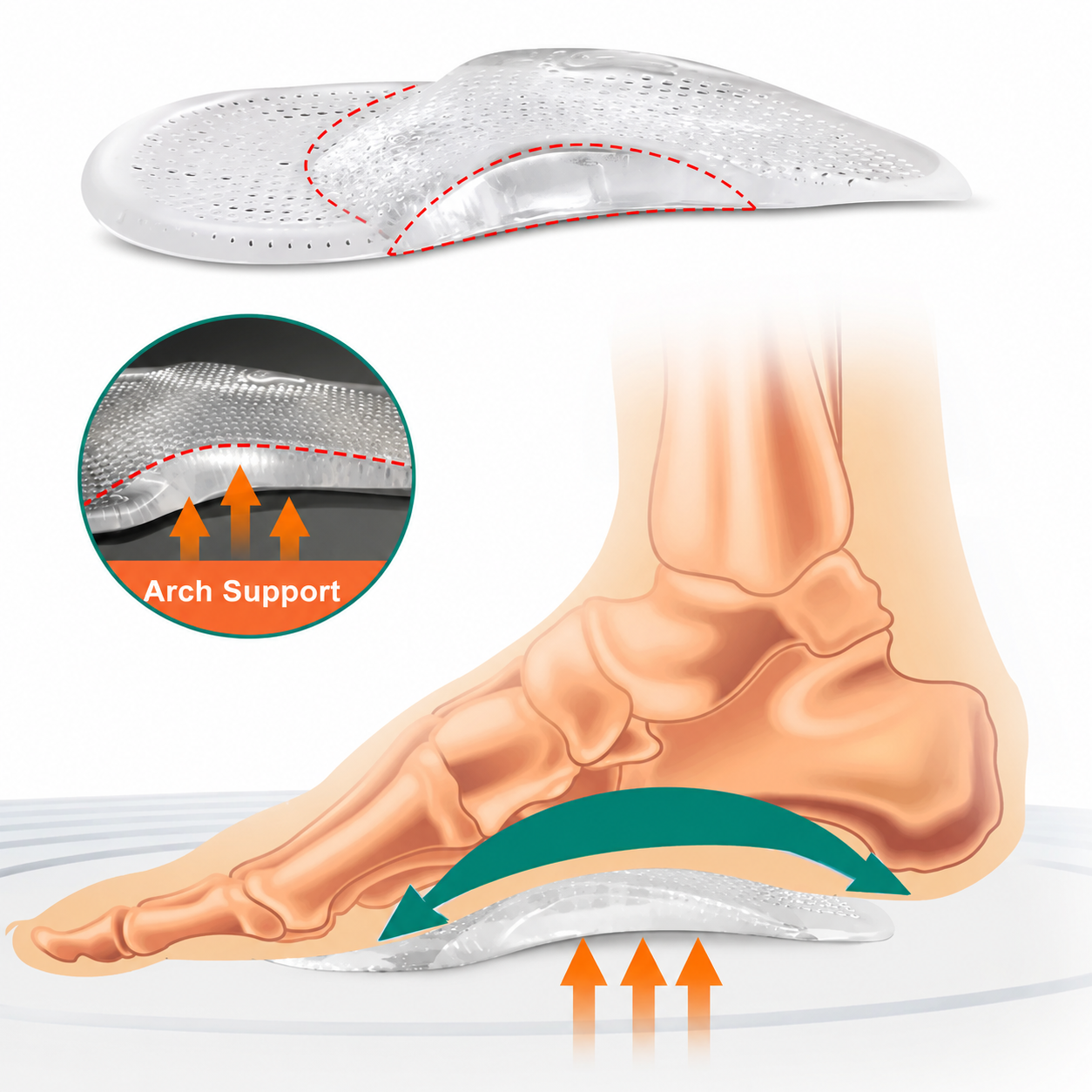 Pain Relief Medial Arch Support Pads