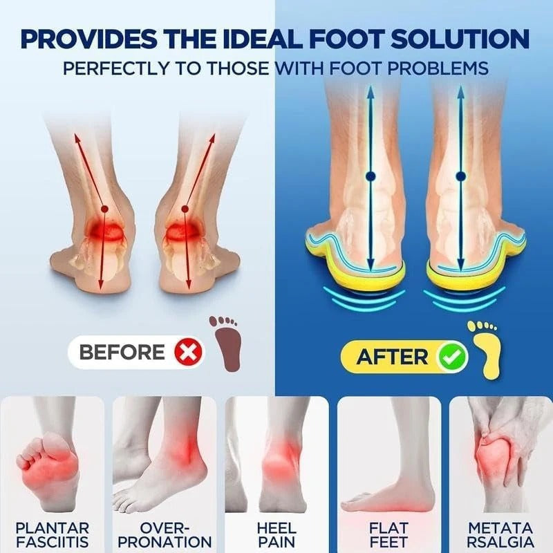 🔥High Quality Magnetic Relief Insoles
